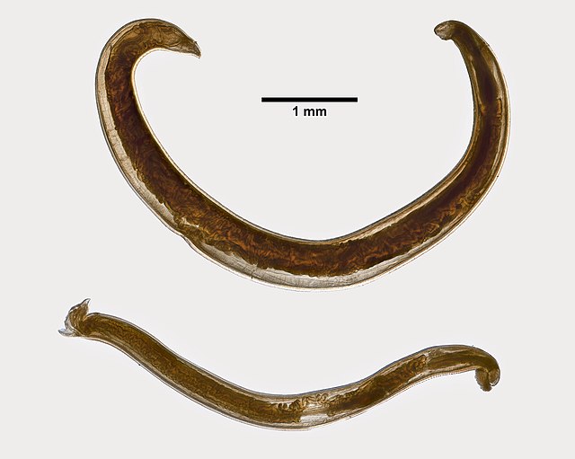 <p>Ancylostoma (Hookworm)</p>