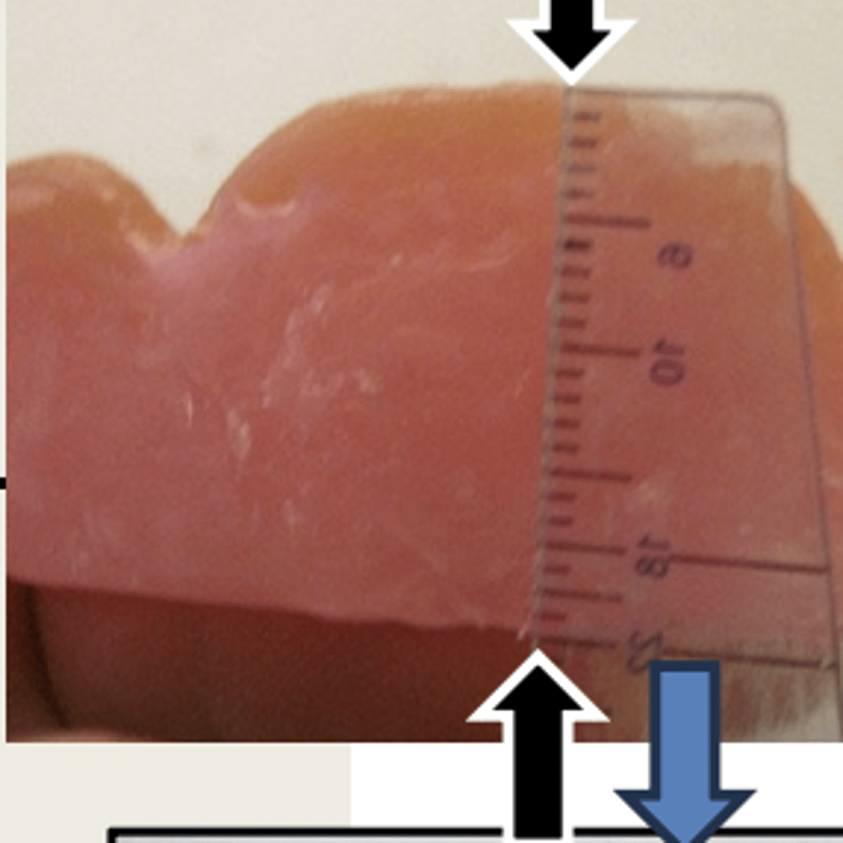 <p>For the Fabrication of the maxillary wax rim, it should have a smooth and flat facial surface which is _____ mm high at the lateral incisors (black arrows)</p>