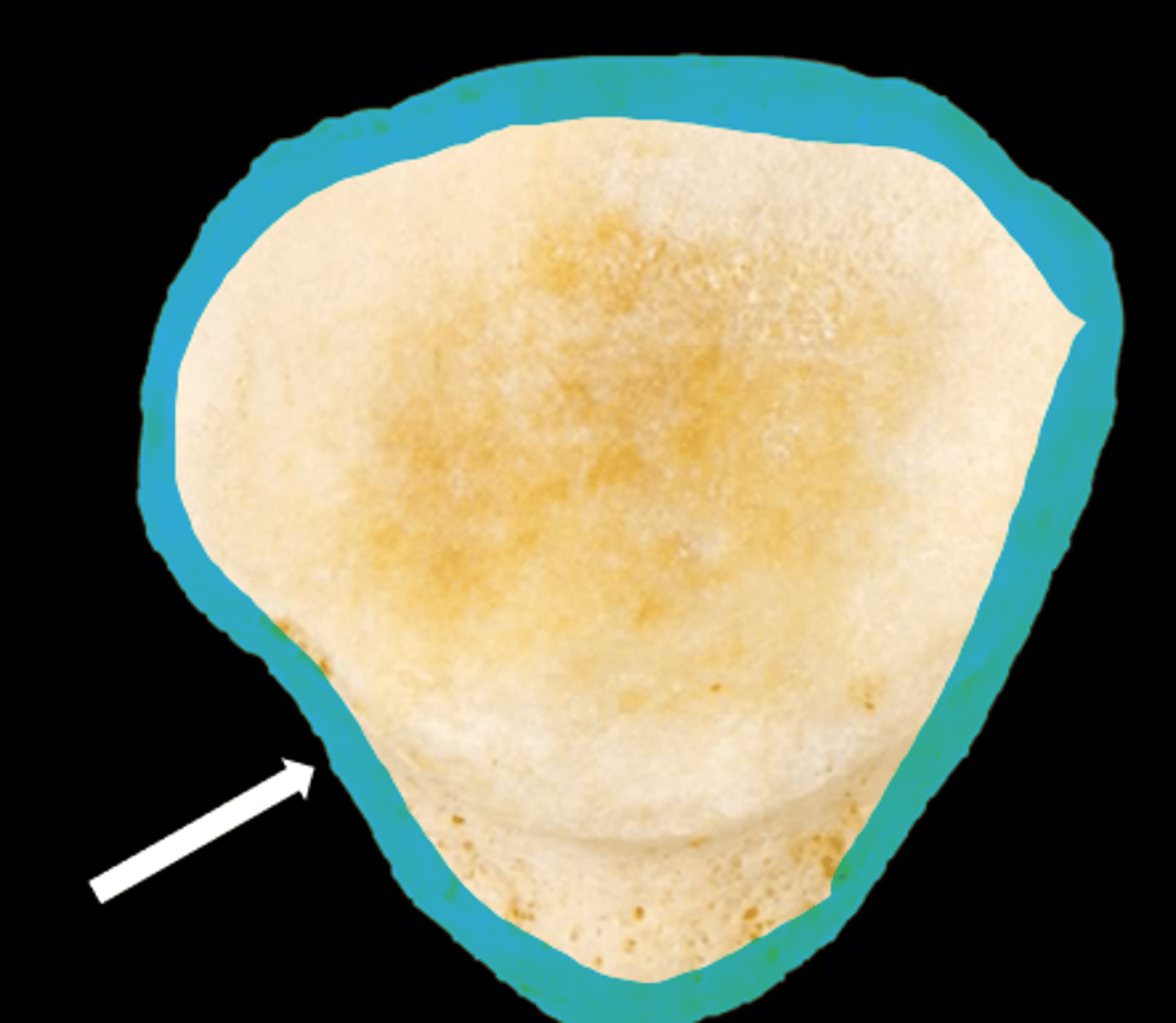 <p>name the bone</p>
