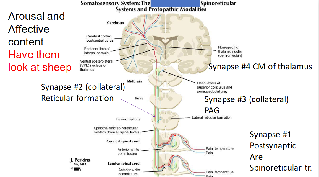 <ol><li><p>Primary neurons have AP at axons which carry to cell bodies in the dorsal horn. These synapse secondary neurons.</p></li><li><p>The secondary neurons decussate (cross) right at the midline and ascend to the reticular formation. There, a collateral or branch of secondary neurons project and synapse to the periaqueductal gray (PAG), which is involved in pain perception. The secondary neurons also synapse tertiary neurons in the reticular formation, which project to the <span>centromedian nucleus (CM) or middle of the thalamus.</span></p></li><li><p>Tertiary neurons in the CM of the thalamus will synapse other cells and generate lots of activity</p></li></ol><p></p>