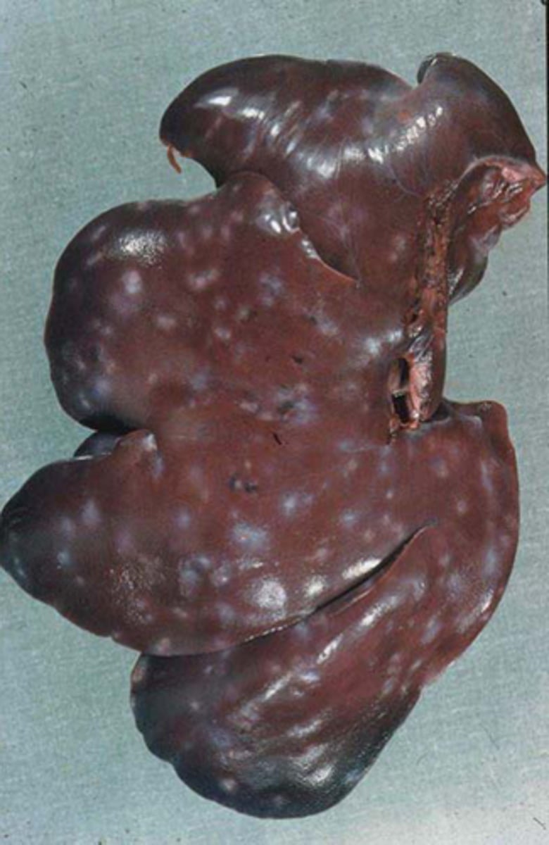 <p>What parasite is associated with the granulomatous lesions "milk spots" seen in this condemned pig liver?</p>
