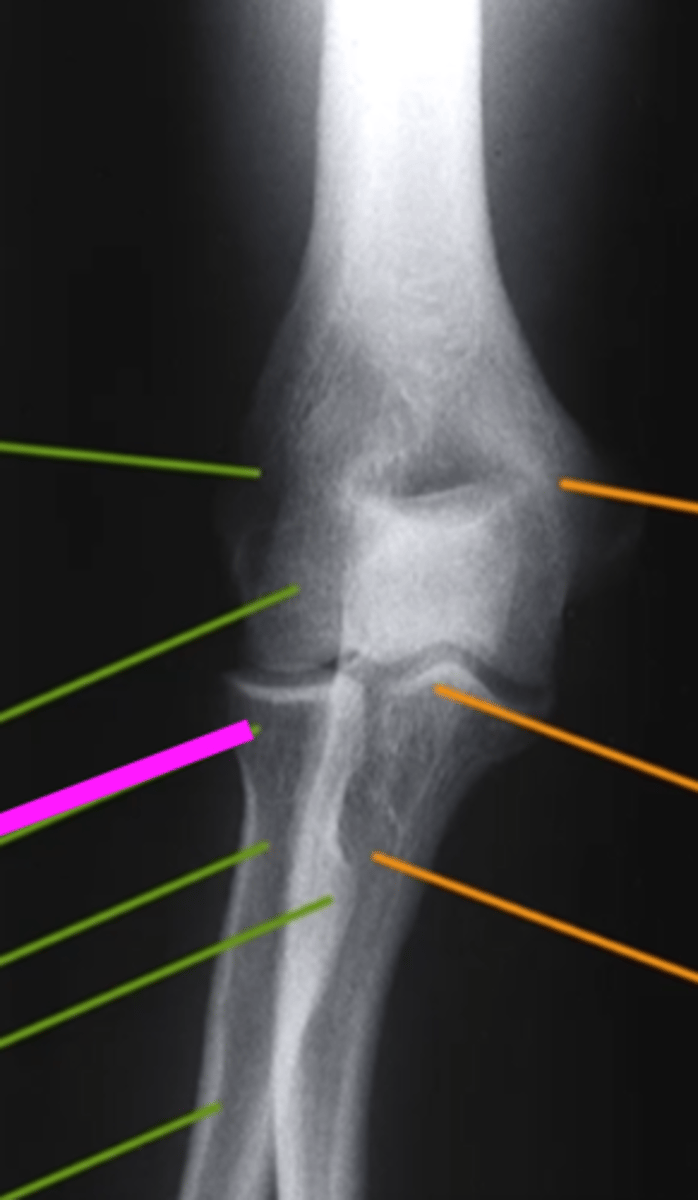 <p>what does the pink line point to?</p>