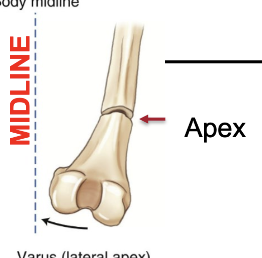 <p>What angulation is this?</p>