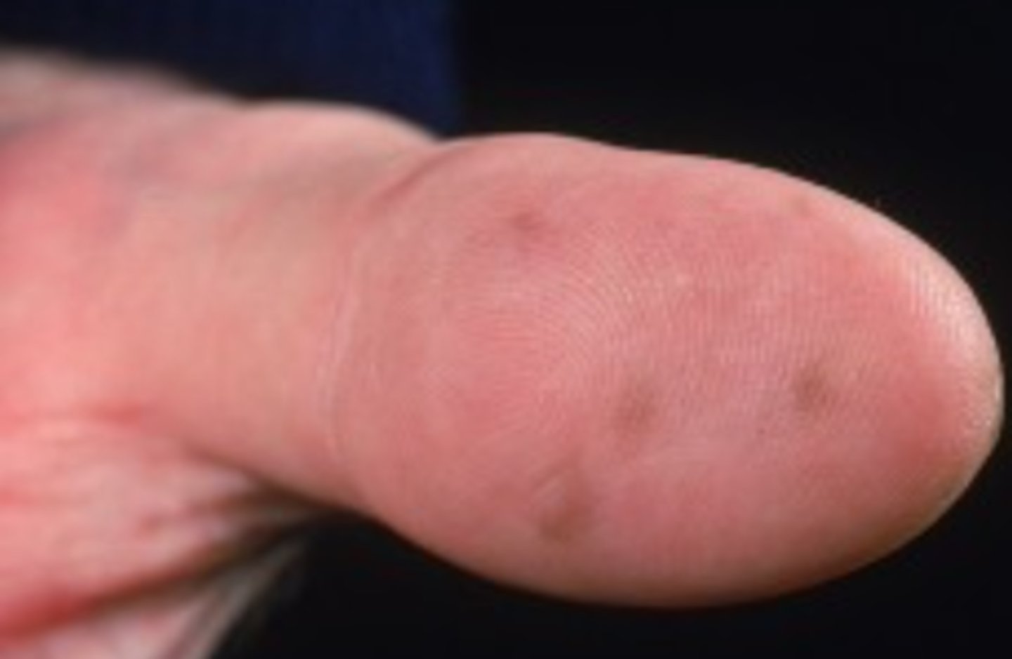 <p>What is the diagnosis?</p>