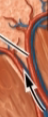 <p>what is this? (branches from segmental artery) kidney</p>