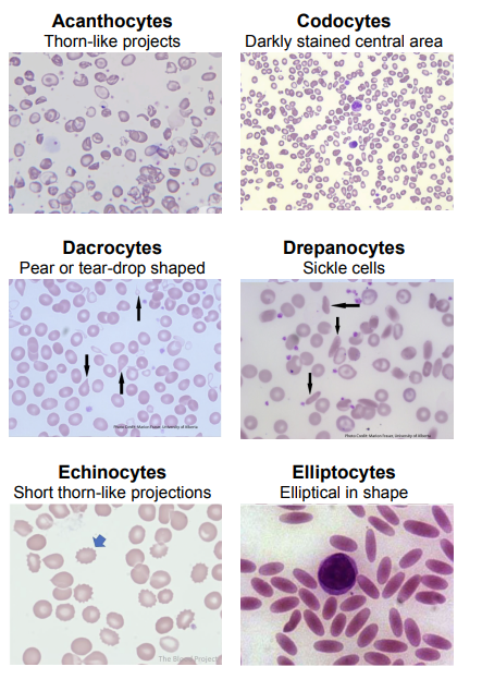<p>Poikilocytosis <span data-name="drop_of_blood" data-type="emoji">🩸</span><span data-name="microscope" data-type="emoji">🔬</span></p>