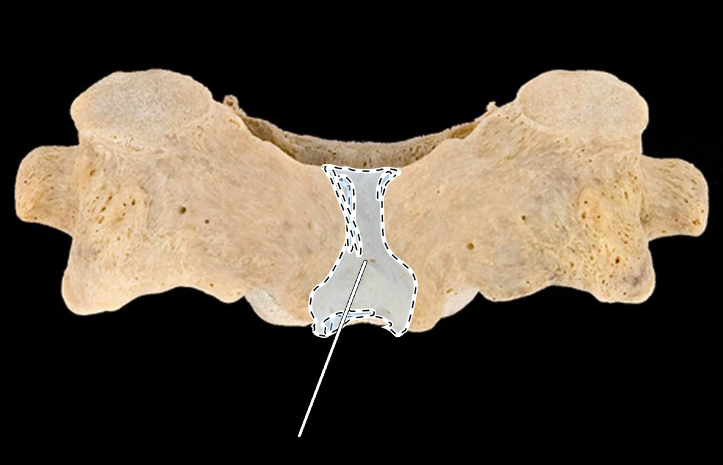 <p>What part of the vertebra is highlighted?</p><p>What type of vertebra is this (which region is this vertebra from)?</p><p>(Posterior view).</p>