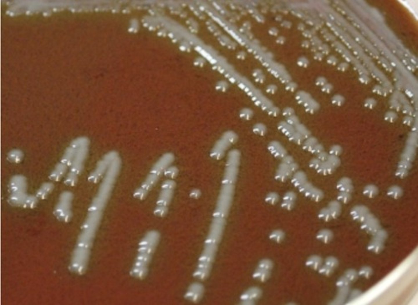 <p>Cause of Tularemia.</p><p>Gram negative coccobacillus.</p><p>Facultative Aerobe. (?)</p><p>Non spore forming.</p><p>Non motile.</p><p>Fastidious.</p><p>Requires cysteine for growth.</p><p>Transmitted by contact with infected animals.</p>