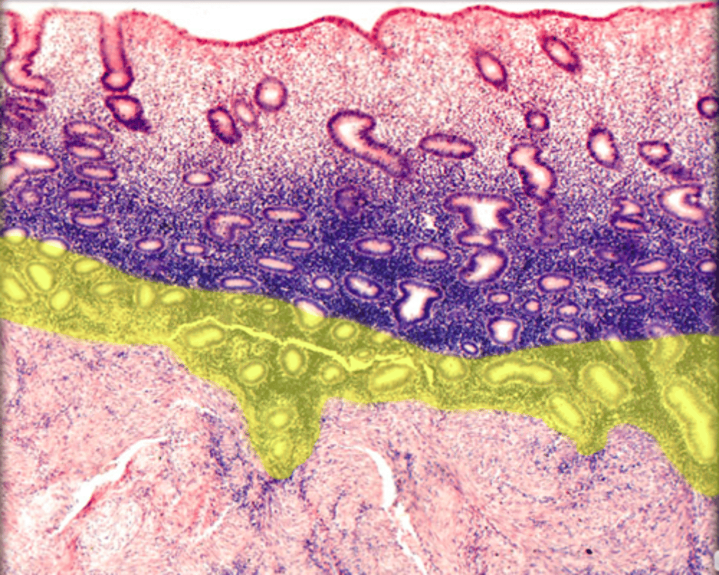 <p>in endometrium</p>