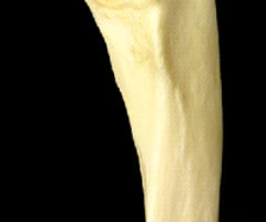 <p>Trochlear notch of ulna</p>