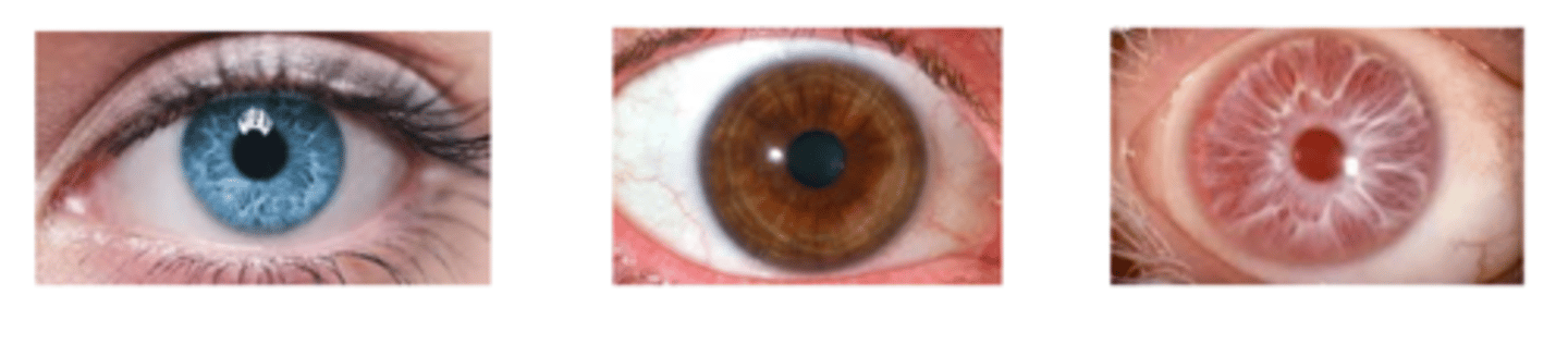 <p>categorical variable with a “value” that is NOT able to be organized in a logical order, sequence or rank</p><p>ex) eye colour</p>