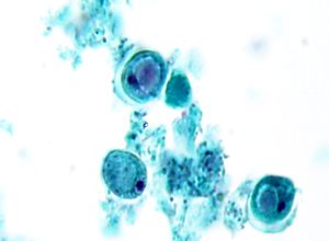 Iodamoeba butshlii cyst