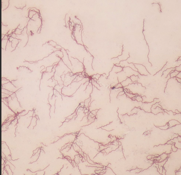 <p>What is the name of this bacterium that causes Lyme disease?</p>
