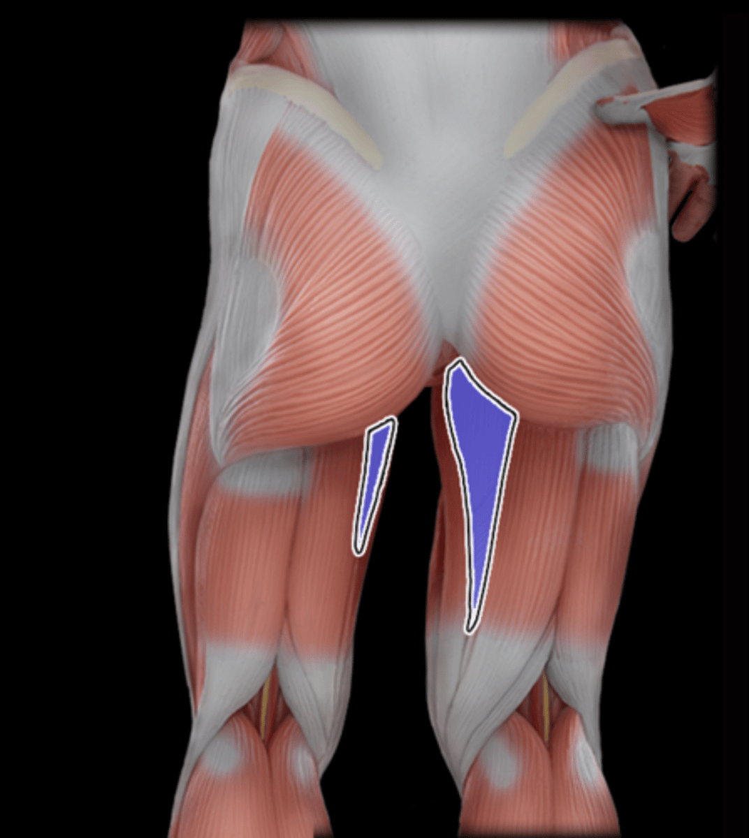 <p>What Muscle Is Highlighted?</p>