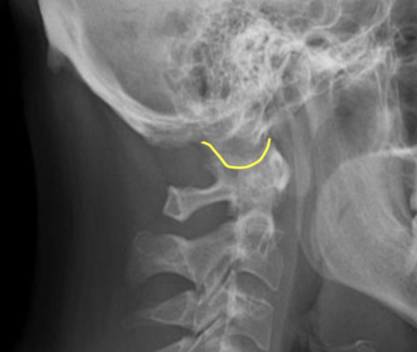 <p>What is the yellow line?</p>