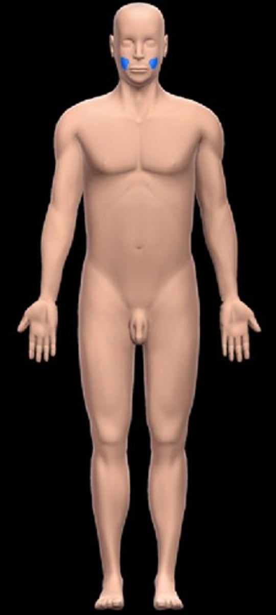 <p>-Location:</p><p>Head (lateral face)</p><p>-Description:</p><p>Region of cheek</p>