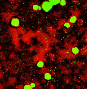 <p>Bact in biofilm moeilijk zuurstof, voeding en AB en ontsmettingsmiddelen krijgen</p><ul><li><p class="MsoListParagraphCxSpMiddle">MIC: min inhiberende concentratie , laagste concentratie die bact groei remt</p></li><li><p class="MsoListParagraphCxSpMiddle">Voldoende om kiem inhiberen, MAAR beneden in biofilm lager dan MIC</p></li><li><p class="MsoListParagraphCxSpMiddle">Sub-MIC in biofilm verhoogt risico op resistentie-inductie</p></li></ul><p class="MsoListParagraphCxSpMiddle">Pos geladen AB kunnen zich binden aan alginaat</p><p class="MsoListParagraphCxSpMiddle">Levende bact met ontsmettingsgroep →heel veel rood, dikke biofilm: groen</p>