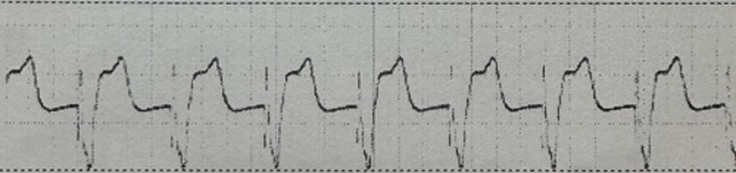 <p>identify the rhythm</p>