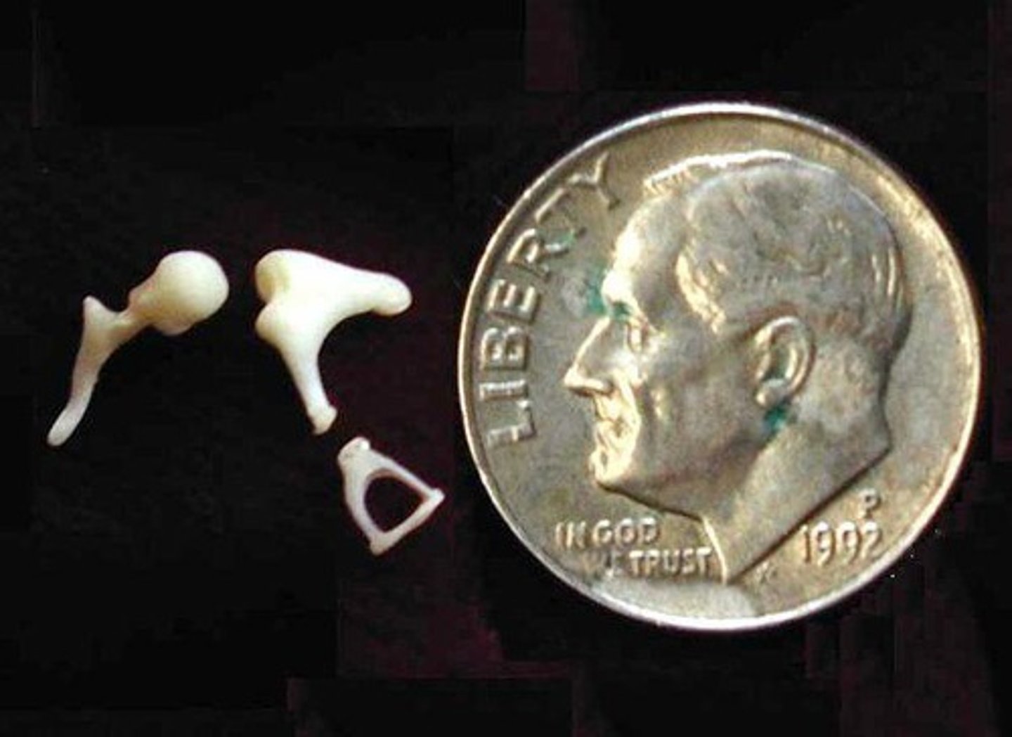 <p>Smallest bones in the body; consists of Malleus, Incus, and Stapes.</p>