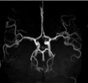 <p>What type of view are we observing the COW at?</p>