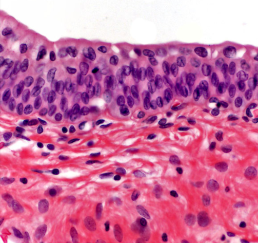 <p>A type of epithelium that can stretch and change shape, found in the urinary bladder and ureters, playing a crucial role in holding and accommodating urine. </p>