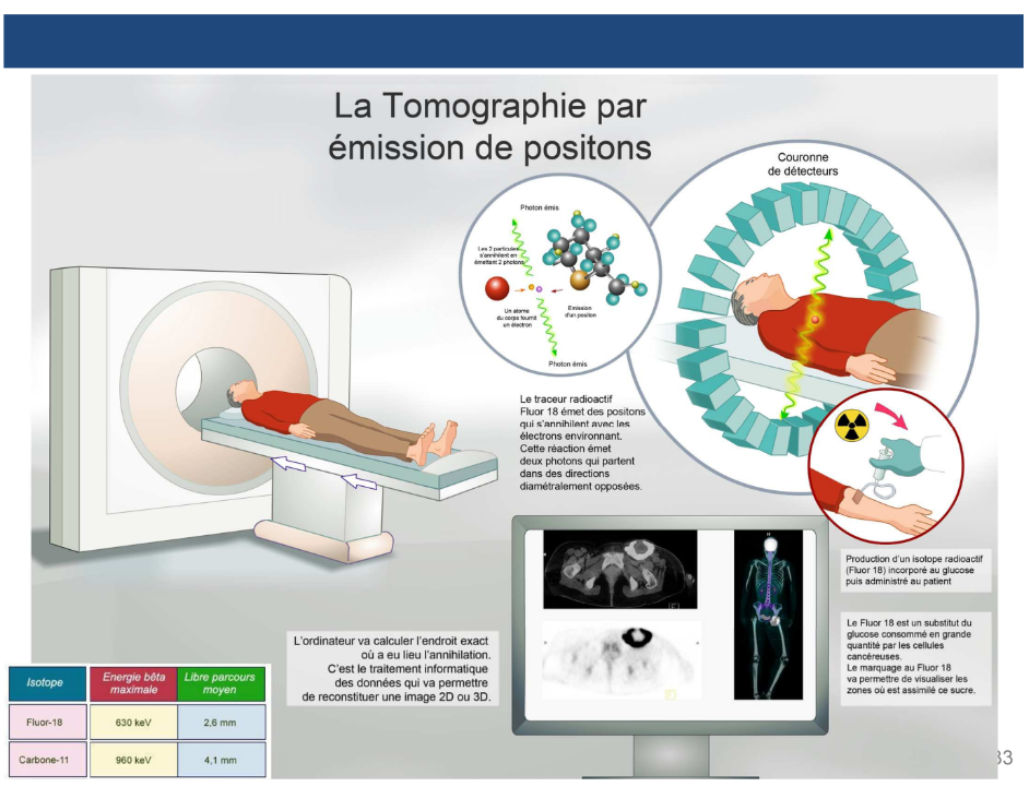 <p>C’est toujours le même principe avec le médicament radiopharmaceutique. On a une structure vectrice sauf qu’on le couple à un <strong>émetteur bêta +</strong> (fluor 18…). On met le patient sous la caméra, le médicament se distribue.</p><p>C’est la technologie qui est un peu différente : On a une couronne de détecteur qui entoure complètement le patient et qui permet de détecter des photons gamma. </p><p>→C’est de <span style="color: red"><strong>l’émission en coïncidence :</strong></span> <span style="color: purple"><strong>on ne va pas détecter la particule bêta + émise </strong></span>car elle a un parcours relativement faible dans la matière (pic de Bragg). L’interaction matière-antimatière : quand un bêta + rencontre un électron, ils vont s’annihiler et ça donne lieu à l'émission incidente à 180° de 2 photons gamma de 511 keV. C’est ça que la caméra va détecter </p><p>Ce principe de <strong>double détection </strong>permet d’être beaucoup plus précis. → La tomographie par émission de positons a une sensibilité et une résolution spatiale bien supérieure à la scintigraphie grâce à ce phénomène.</p>
