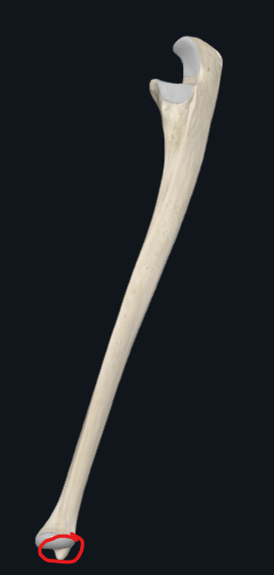 <p>What is this part of the ulna called</p>