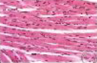 <p>Identifica el tejido</p>