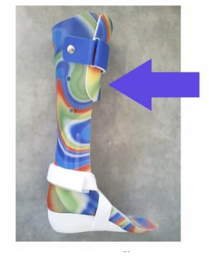 <p>Proprioceptive feedback for knee </p><p>extension</p><p>Often set in slight PF </p><p>Commonly used for →</p><p> Spina bifida</p><p> SCI with limited sensation</p><p> Poor knee control but good hip control </p>