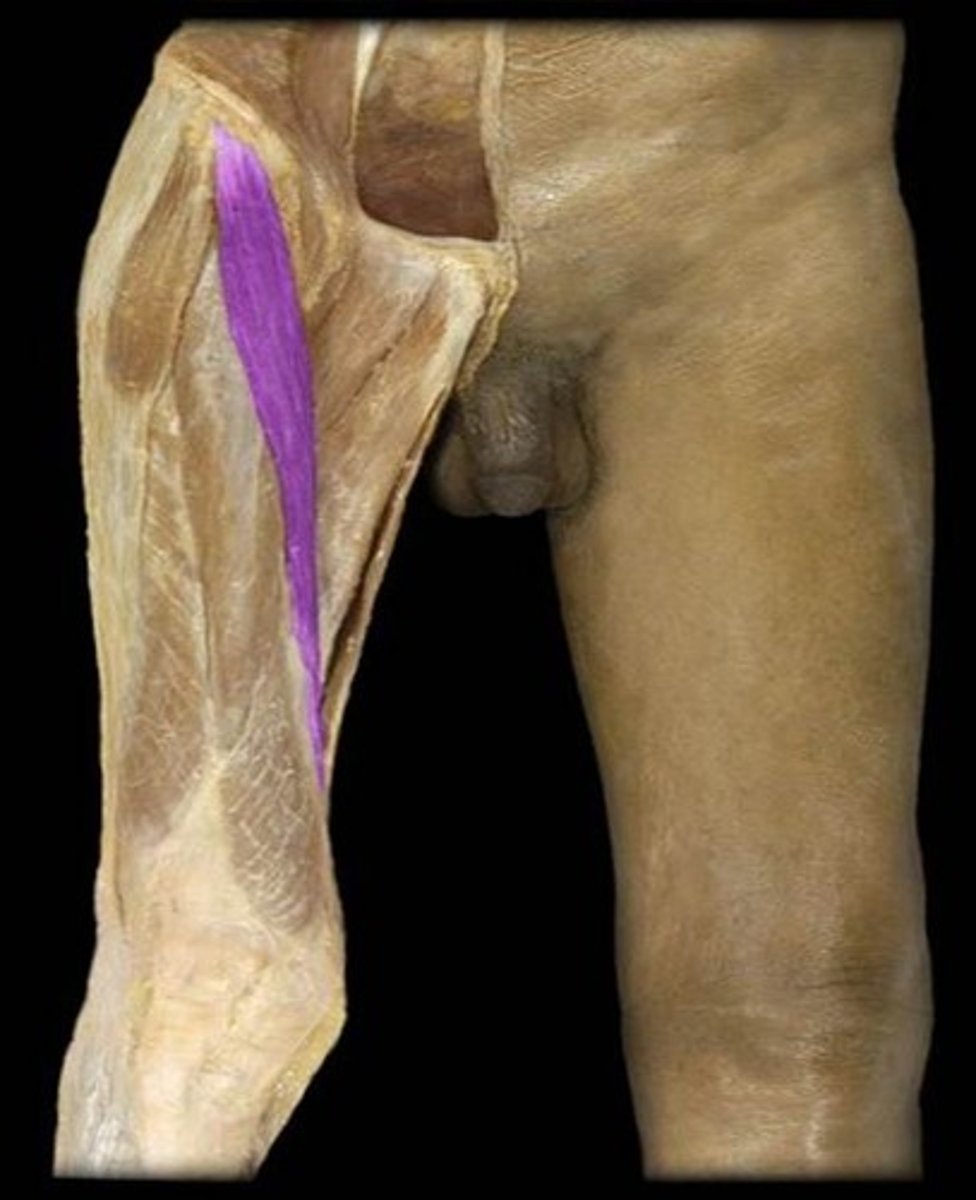 <p>What is the name of this muscle, highlighted in purple?</p>