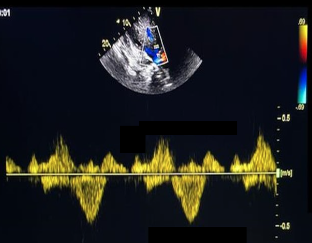 <p>Identify this image. </p>