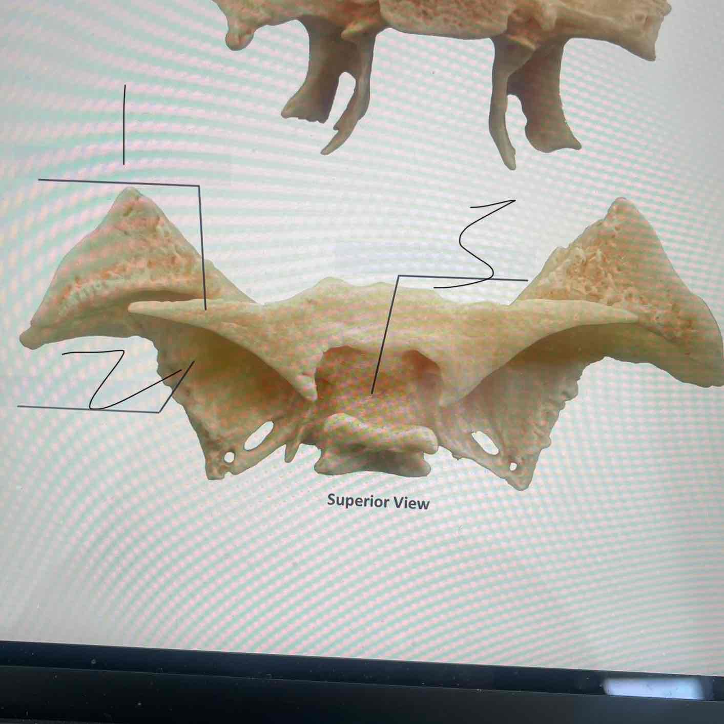 <p>What kind of bone is this?</p>