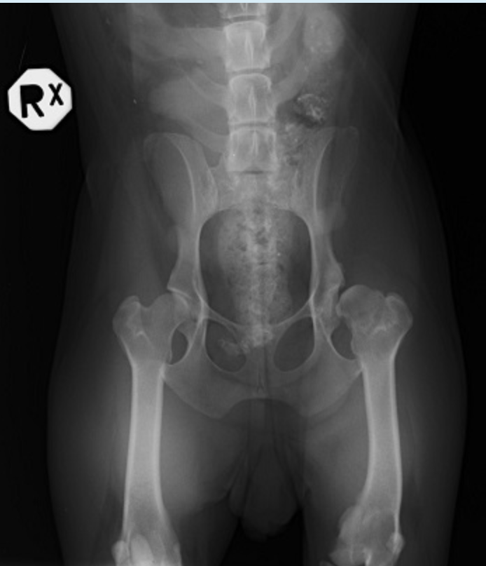 <p>Radiographic report - pathology</p>