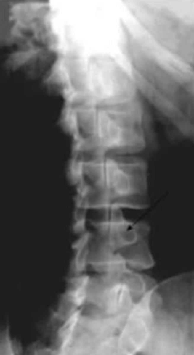<p>What part of bone is the arrow pointing to?</p>