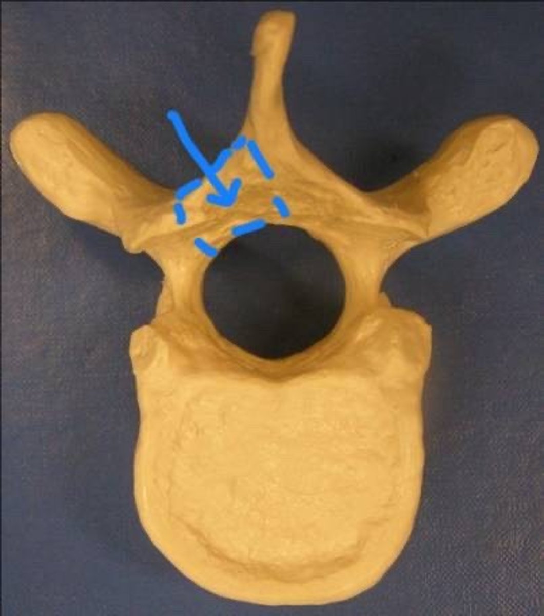 <p>portion of vertebral arch between transverse process &amp; spinous process</p>