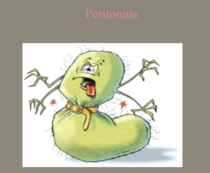 <p>Peritonitis</p>