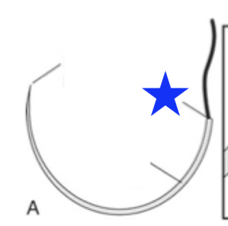 <p>What part of the surgical needle is indicated by the blue star?</p>