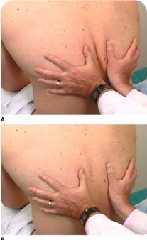 <p><span>Using fingers, gently palpate the entire chest wall</span><br><span><strong>Respiratory (or thorax) expansion</strong>: place your thumbs along the level of the 10th rib on both sides of the spine and lay your palms on the client's back, making a “W” with your hands. Ask your client to take a deep breath, and as they inhale, your thumbs should symmetrically spread apart</span><br><span><strong>Tactile fremitus</strong>: ask the client to say “99” repeatedly while palpating both sides of their posterior chest</span></p>