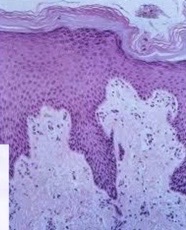 What type of epithelia? Where could it be located?