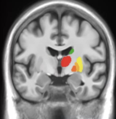 <p>Thalamus</p>