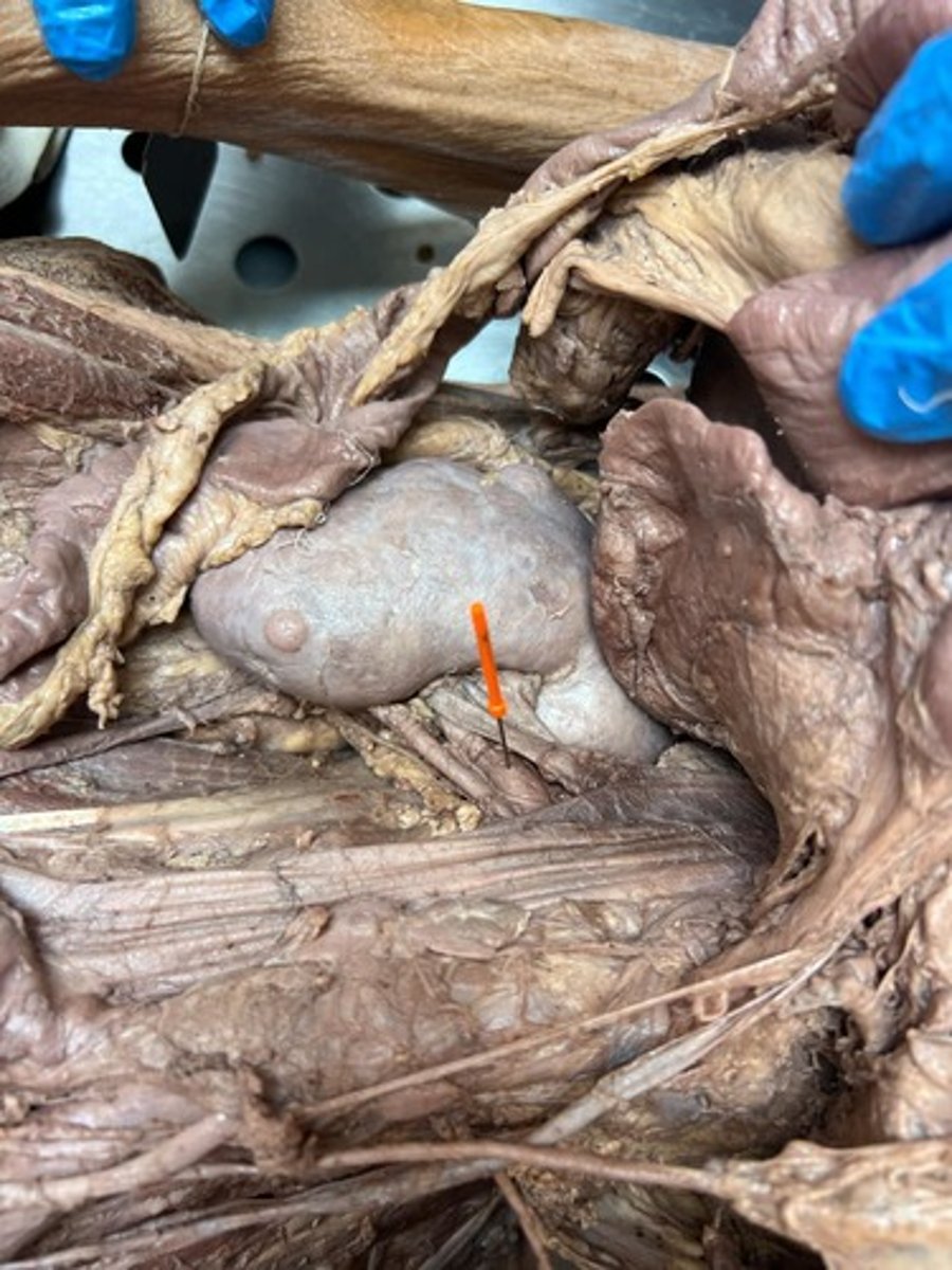 <p>l-r renal artery</p>