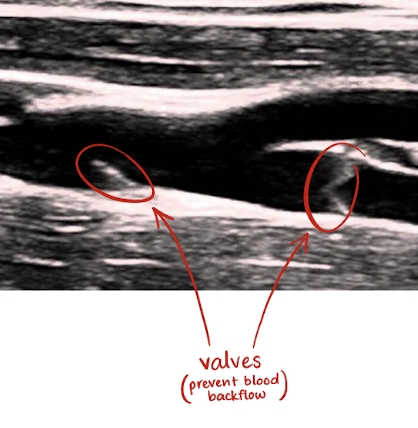 <ul><li><p><u>return deoxygenated blood to heart</u> using valves in its low-pressure system</p></li><li><p><u>valves prevent</u> retrograde or <u>backflow</u> of blood <u>during diastole</u></p></li></ul><p></p>