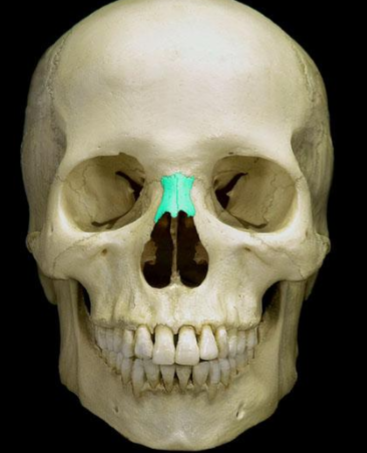 <p>What bone is this?</p>