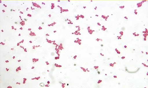 <p><span style="font-family: Arial, sans-serif; line-height: 115%;">Coccus</span></p>