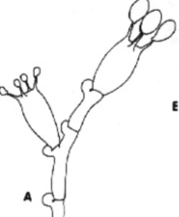 <p>what type of sexual spore is this</p>
