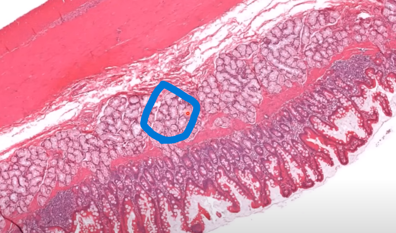 <p>Organ?</p><p>Region?</p><p>Structures circled?</p><p>Structure between muscular layers?</p><p>Cells at base of crypts?</p>