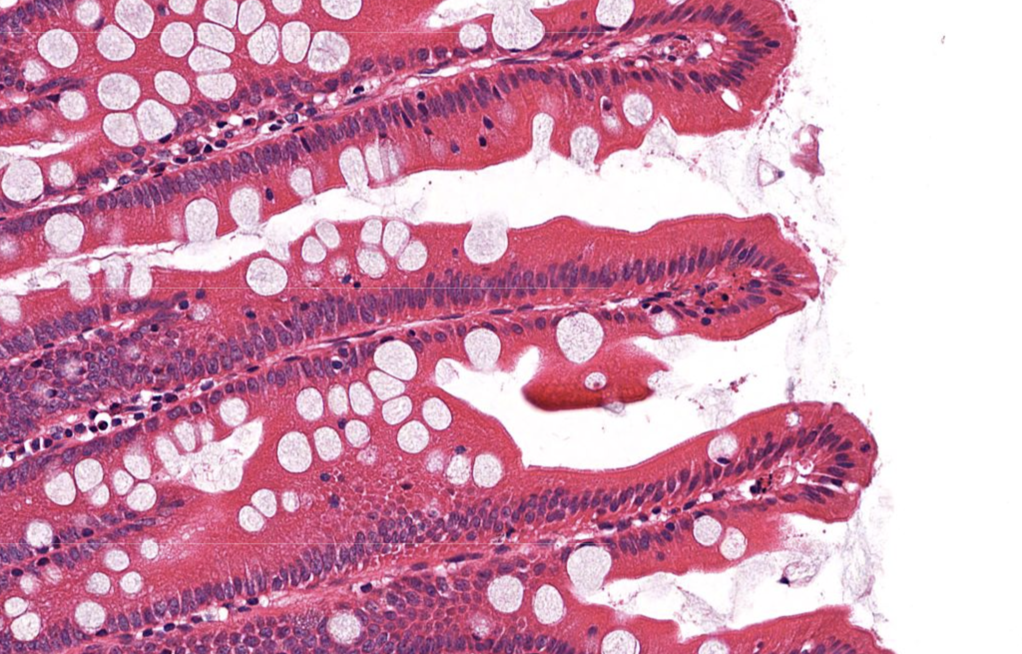 <p>Villi in Duodenum</p>