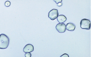 <p>Identify the urine sediment element shown:</p>