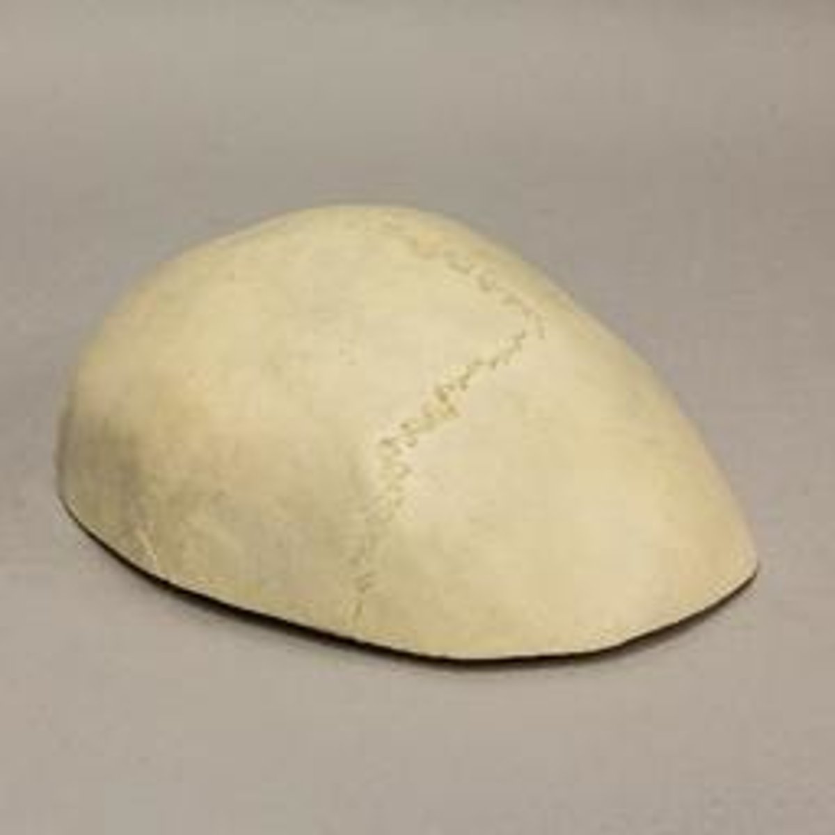 <p>skull cap, portion of neurocranium consisting of the frontal, parietal and occipital bones</p>