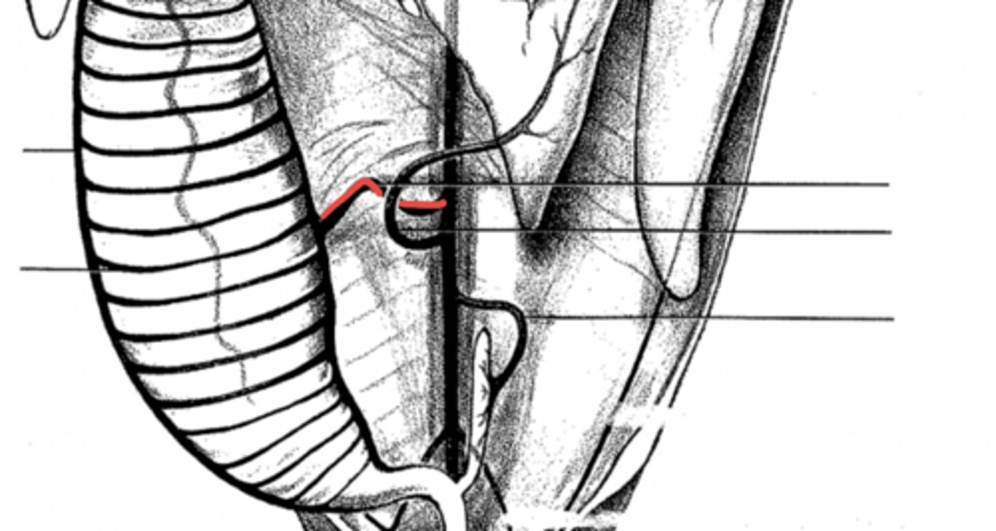 <p>where does the posterior intestinal artery get its blood from?</p>